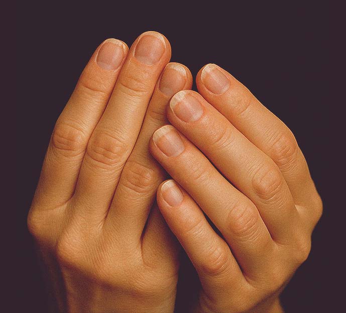 Brittle Nails