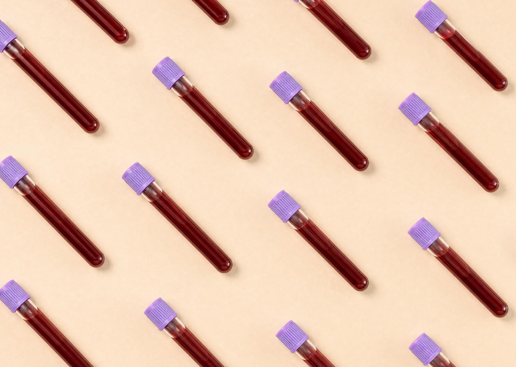 Reading Your Blood Test Results: What Do The Numbers Actually Mean?
