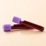 Blood Tests