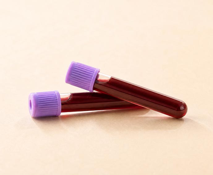 Blood Tests